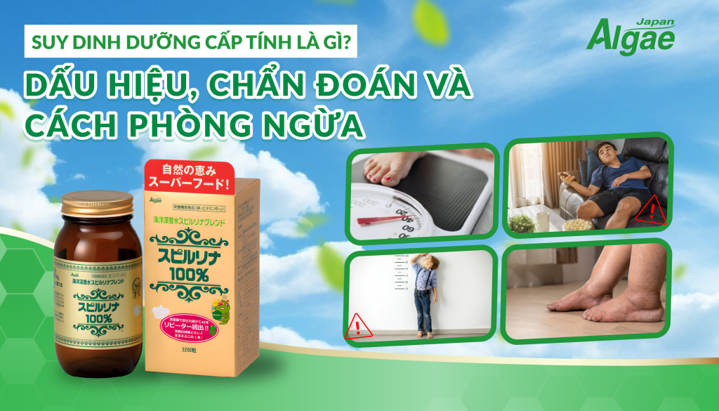 suy dinh dưỡng cấp tính là gì