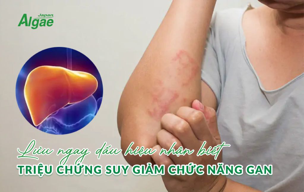 trieu-chung-suy-giam-chuc-nang-gan-1